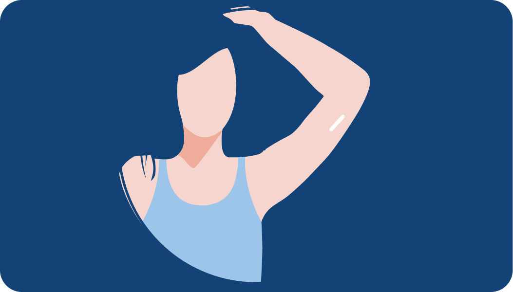 Visual of the Size of an Implant Relative to a Person's Hand